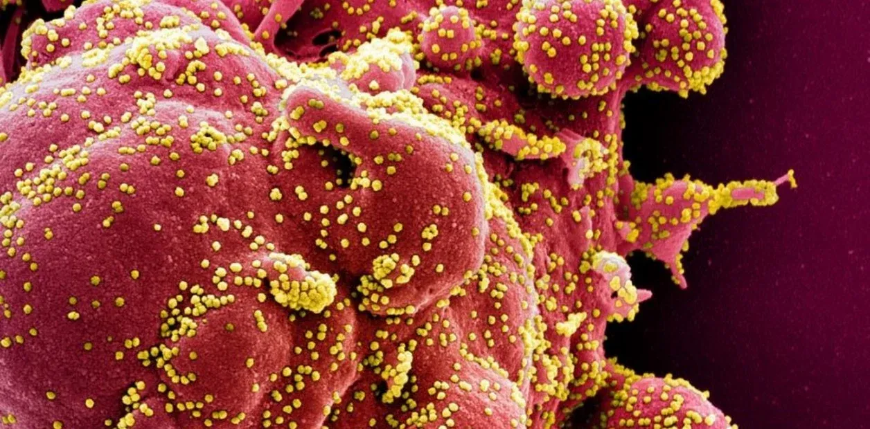 El avance de la pandemia

Coronavirus: descubren la clave para “desnutrir” al Covid y evitar que se reproduzca en los pulmones