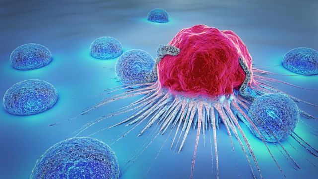Tomar decisiones respecto del tratamiento contra el cáncer