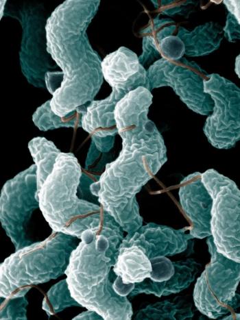Campylobacter otro factor para el sindrome de Guillain-Barré