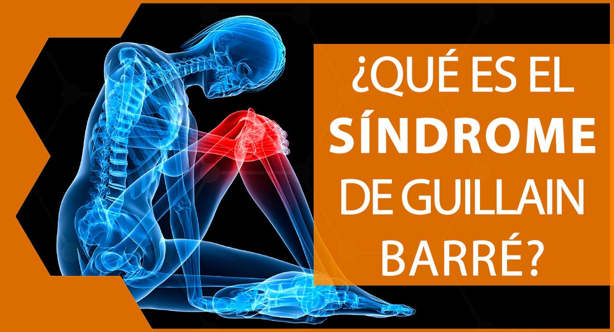 ¿Cuál es la relación que existe entre Campylobacter jejuni y el síndrome de Guillain Barré?