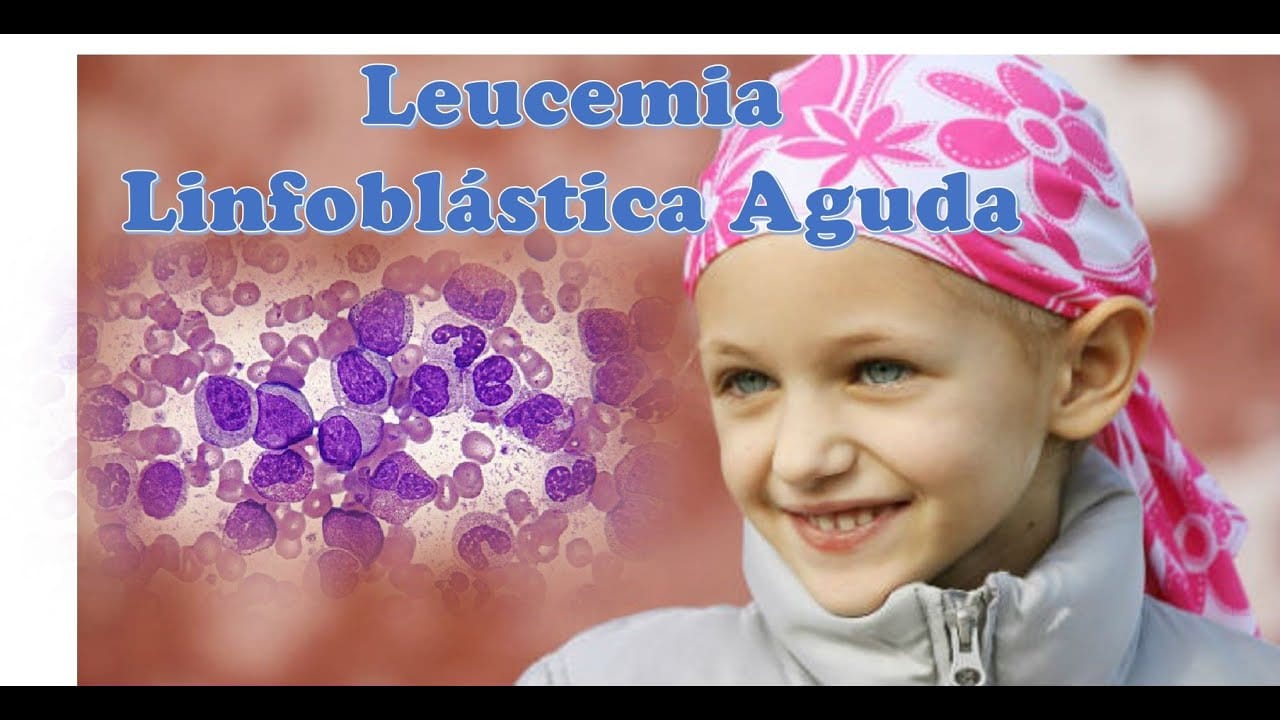 Leucemia Linfoblástica Aguda en Sonora: Causas Potenciales y Síntomas a Detectar